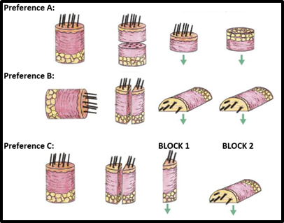 Alopecia Specimen Orientation